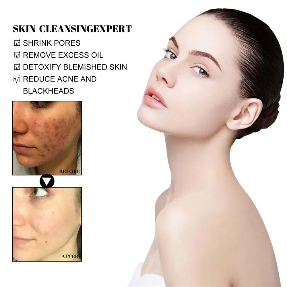 West & Month Blackhead Mud Mask Oil Control Treatment