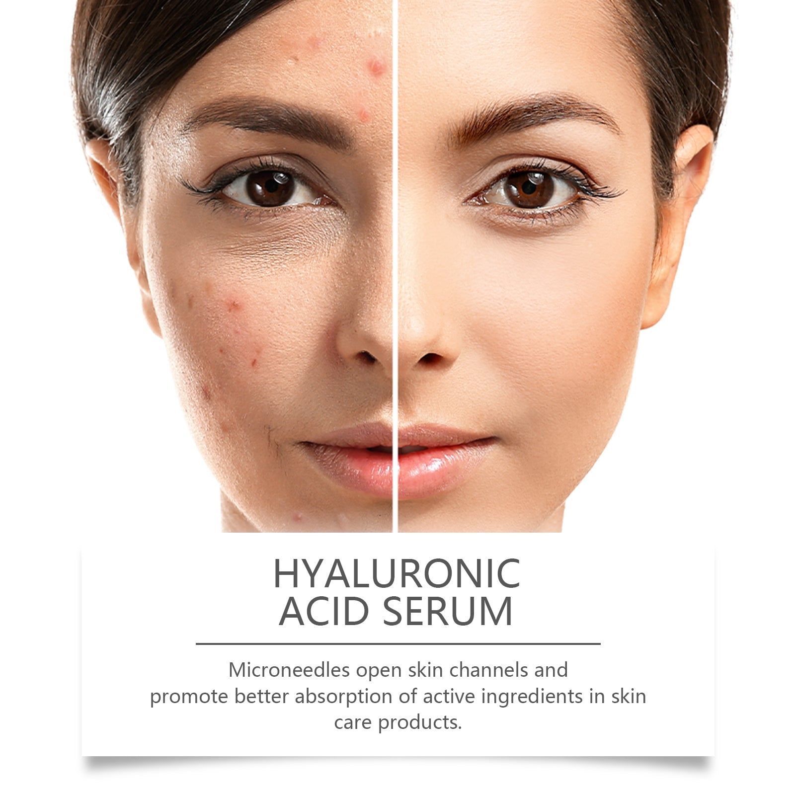 Hyaluronic Acid Face Serum for Hydrated Radiant Skin
