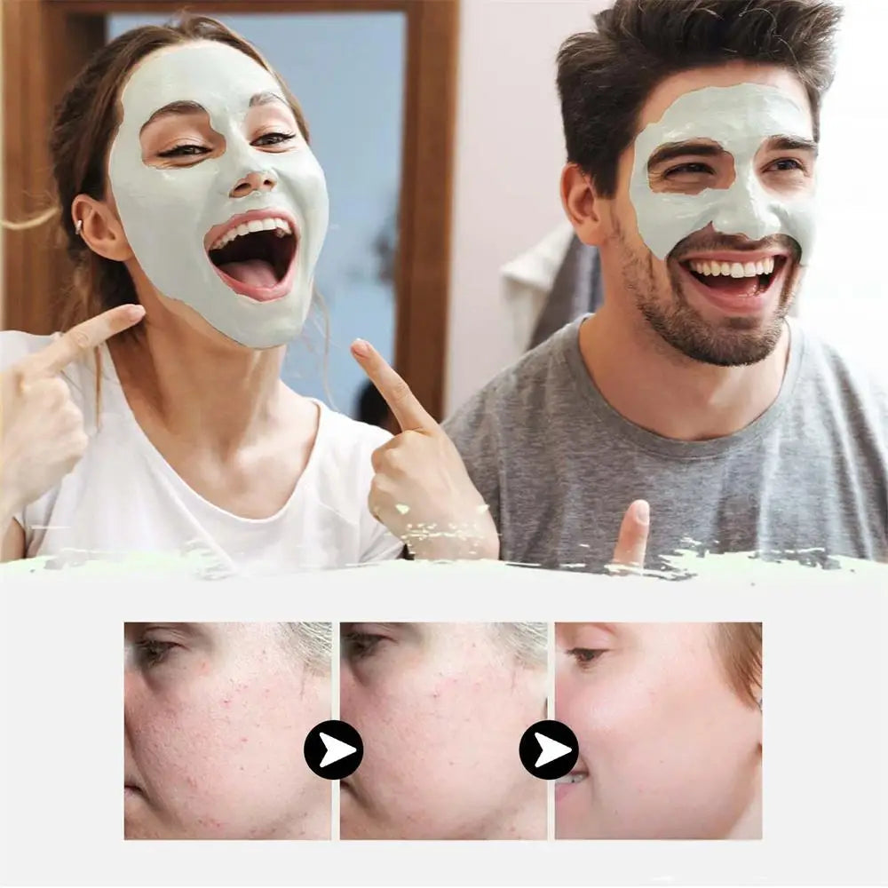 West & Month Blackhead Mud Mask Oil Control Treatment