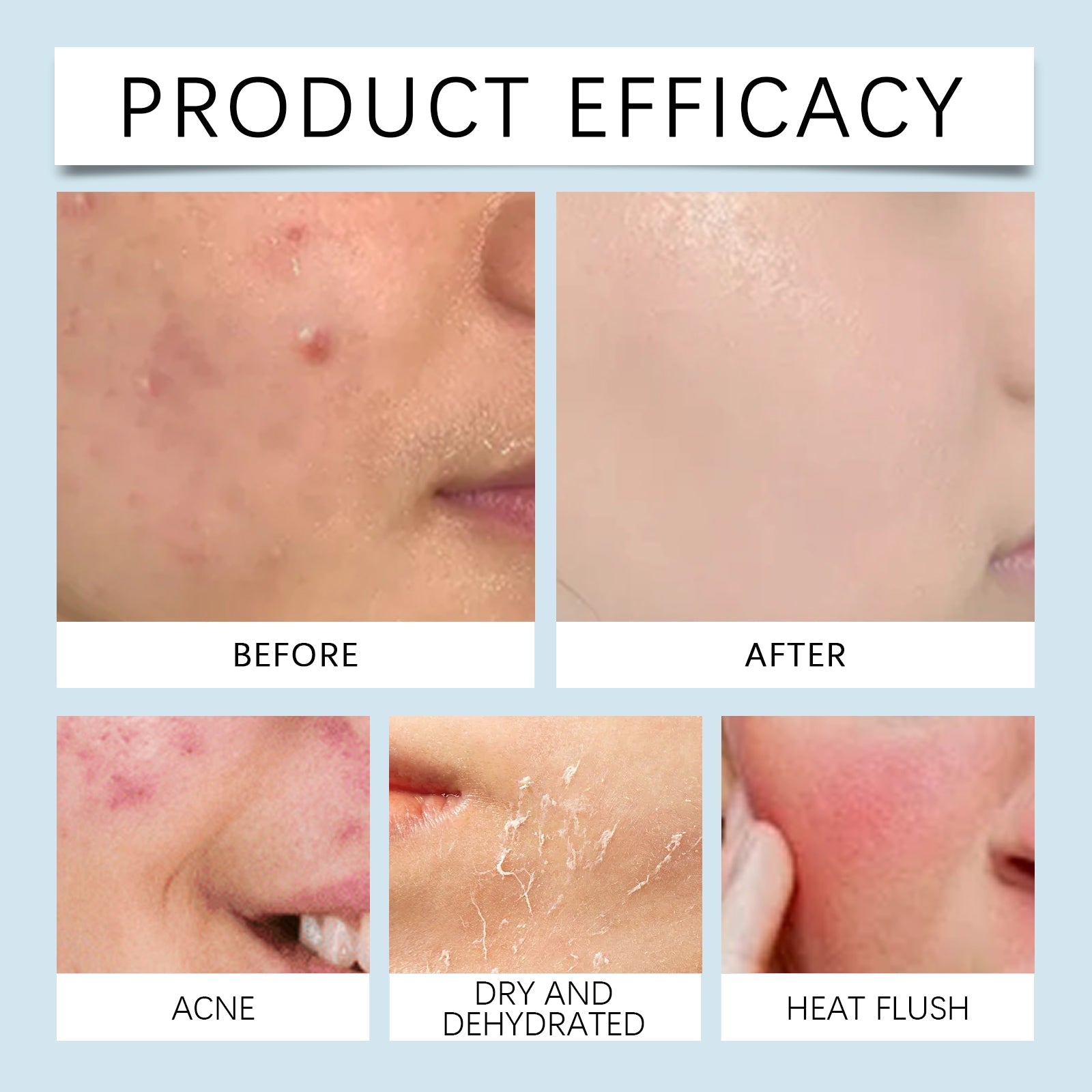 Hyaluronic Acid Face Serum for Hydrated Radiant Skin